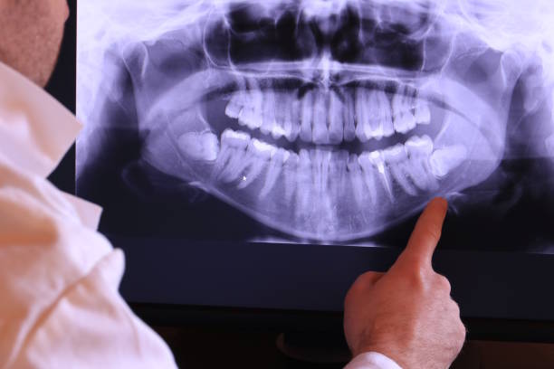 Best Broken or Chipped Tooth Repair in Haverhill, FL